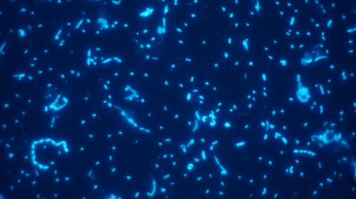 To make visible marine microbes using more sophisticated microscopy such as a epifluorescence microscope, they have to be dyed with a fluorescence stain [Photography: Meinhard Simon, ICBM].