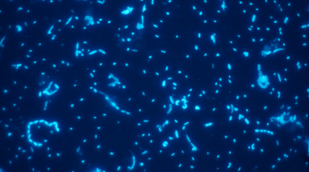To make visible marine microbes using more sophisticated microscopy such as a epifluorescence microscope, they have to be dyed with a fluorescence stain [Photography: Meinhard Simon, ICBM].