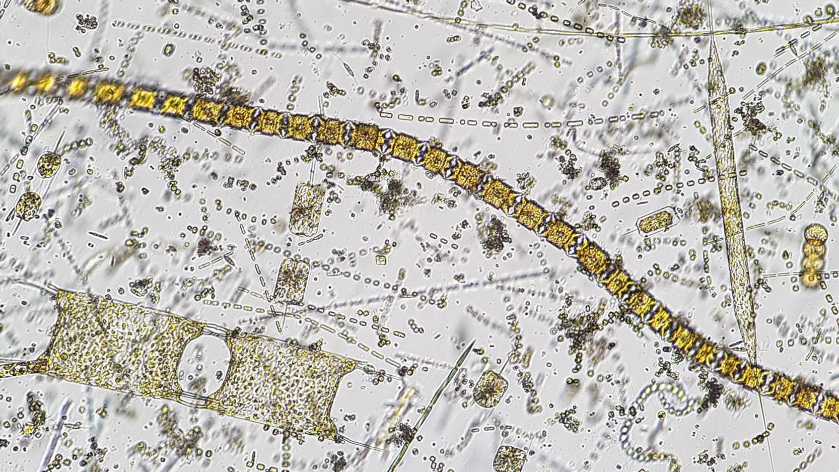 Die Zellgröße vieler Diatomeen, ähnlich denen auf diesem Bild, hat sich im Wattenmeer in den vergangenen Jahren deutlich verringert [Bild: Universität Oldenburg/Patrick Thomas].