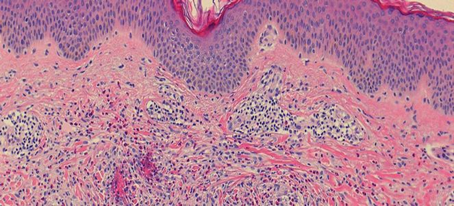 Abteilung für experimentelle Allergologie und Immundermatologie