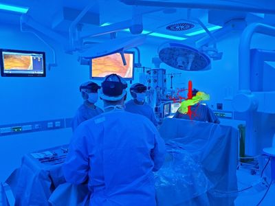 Use of augmented reality in the operating room with a patient-specific 3D organ model