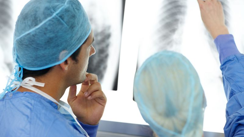 Zwei Ärzte sehen ein Röntgenbild der Lunge an.