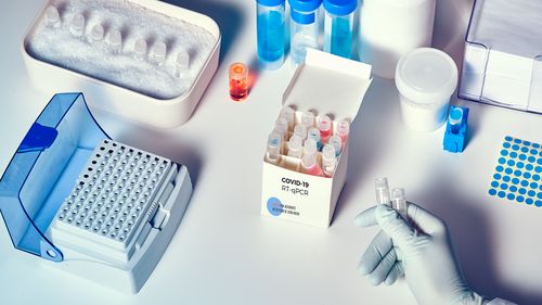 The picture shows a test kit consisting of some samples, a special container to amplify the virus RNA and other laboratory material.