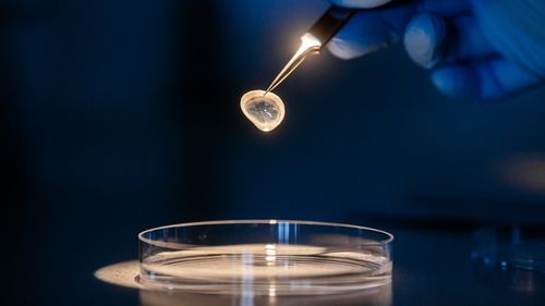 A hand with tweezers holds a cornea.