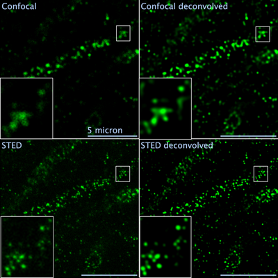 STED and confocal deconvolved