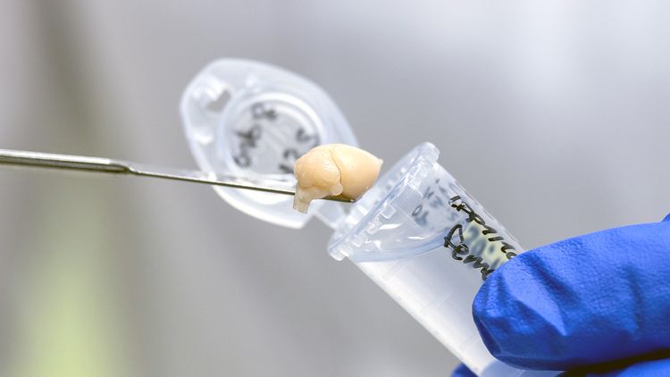 A mouse brain is lifted out of a tube containing liquid using a laboratory spoon.