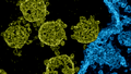 The electron micrograph shows several viruses attacking a cell. The spike proteins can be clearly seen. 