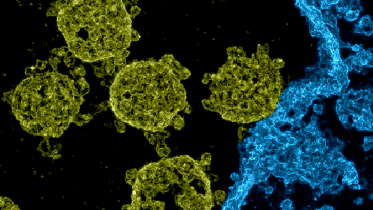 Die elektronenmikroskopische Aufnahme zeigt mehrere Viren beim Angriff auf eine Zelle. Die Spike-Proteine sind deutlich zu erkennen.   