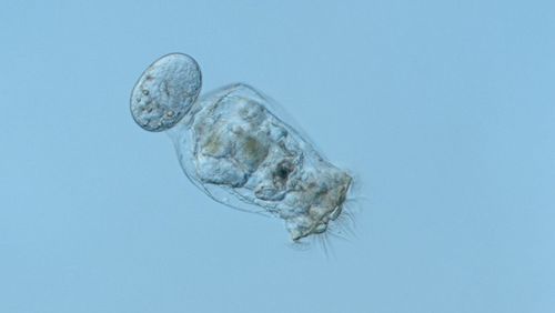 Microscoopic picture of a rotifer.