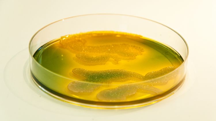 Petrischale mit Vibrio-Kulturen