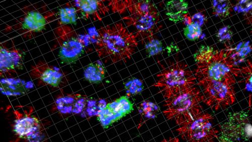 A number of differently colored algal cells are spread across the image against a black background, some have tuft-like hairs. They are colonised by bacteria to varying degrees.