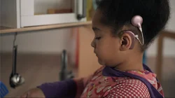A little girl with a Cholea implant is playing.