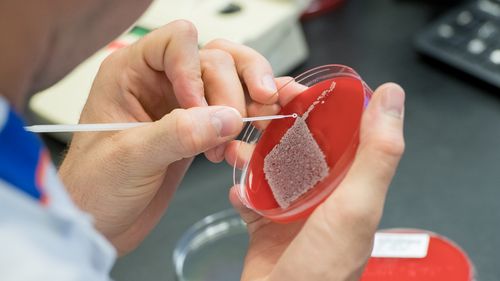 Close up of Petri dish with bacterial cultures