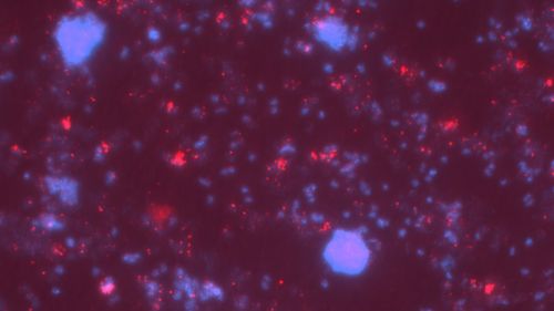 Pattern of larger and smaller blue and red dots, irregularly distributed on a dark background.