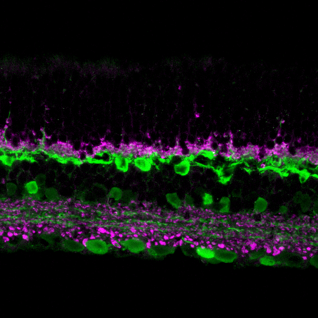 Sehen: Komplex & wundervoll!  —  	Elena-Maria Iatropoulou Bannat — Ich erforsche wie sich die Struktur der Retina verändert, wenn Cadherin2 ausgeknockt wird (Cadherin2 = ein Protein zuständig für Zell-Zell Adhäsion). Die Retina, oder Netzhaut, ist eine dünne Schicht (ähnlich dick wie ein Haar!) die aus bestimmten Zelltypen besteht. Jede Zelle ist spezialisiert, und folgt einer “Rangordnung”, aber verliert diese Rangordnung Ihre eigentliche Struktur, verschlechtert sich das Sehvermögen. Kann dieses Protein uns helfen, eines Tages wieder besser zu sehen? (Mausretina, 63x Obj., Konfokalmikroskop Vergrößerung.)